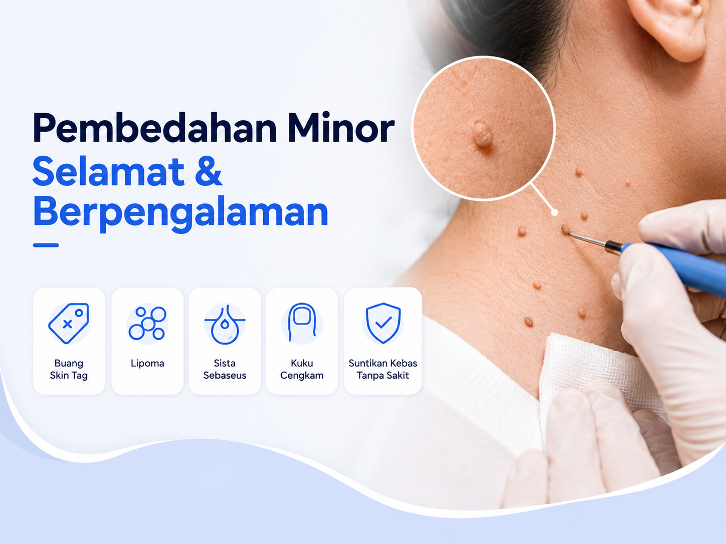 Minor Surgery PrimeHealth