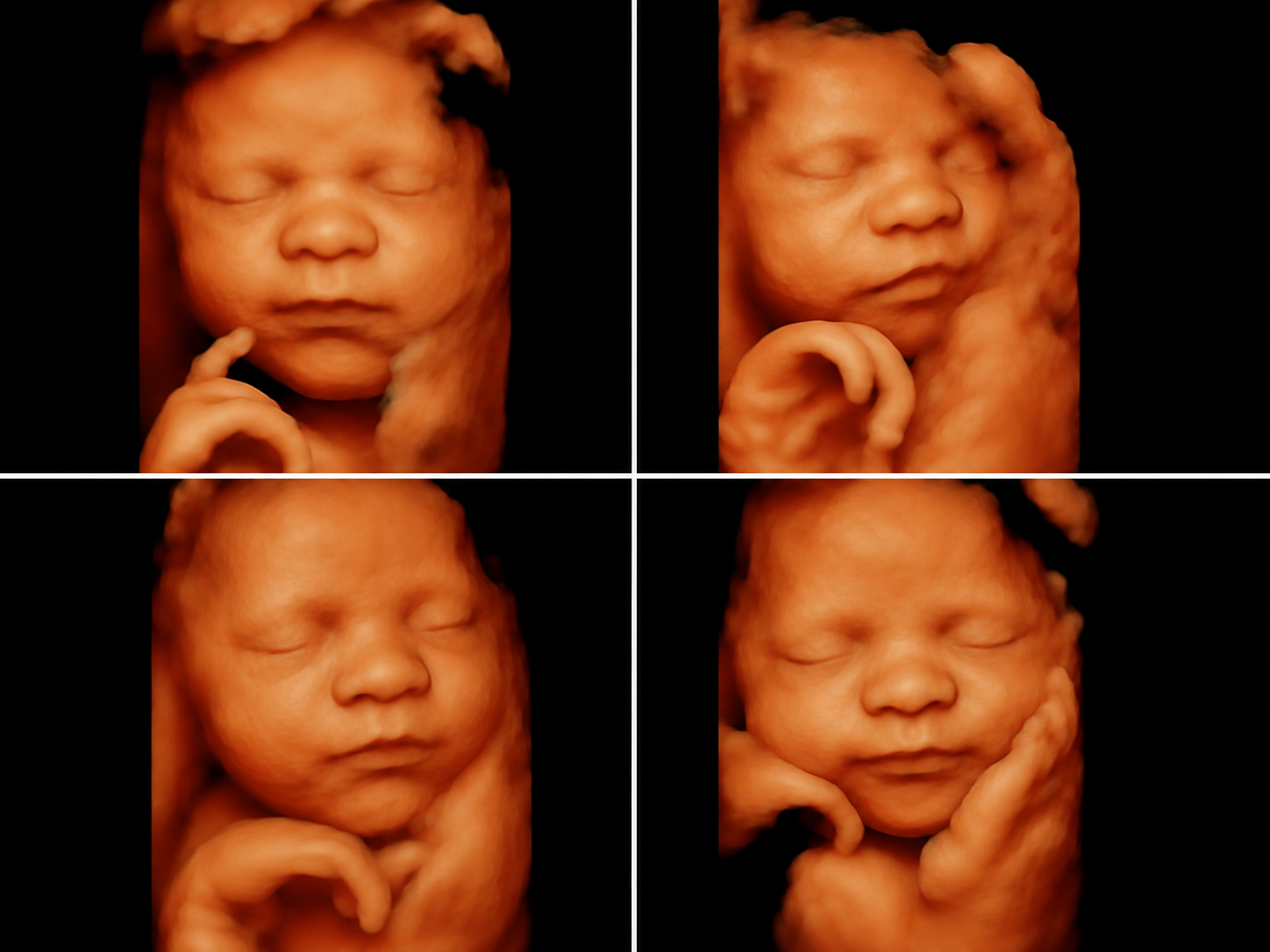 Pakej Scan Baby PrimeHealth